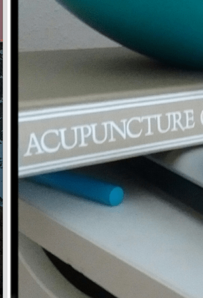 AA_acupuncture