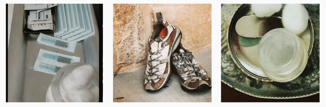 Acupuncture needle packs, sneakers, cupping tools