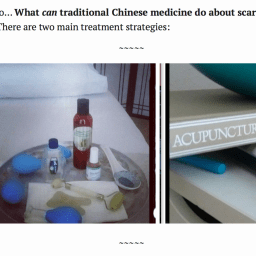 Scar Removal, Part II: Two Reasons To Remove Your Scar And Two Good Reasons To Keep It